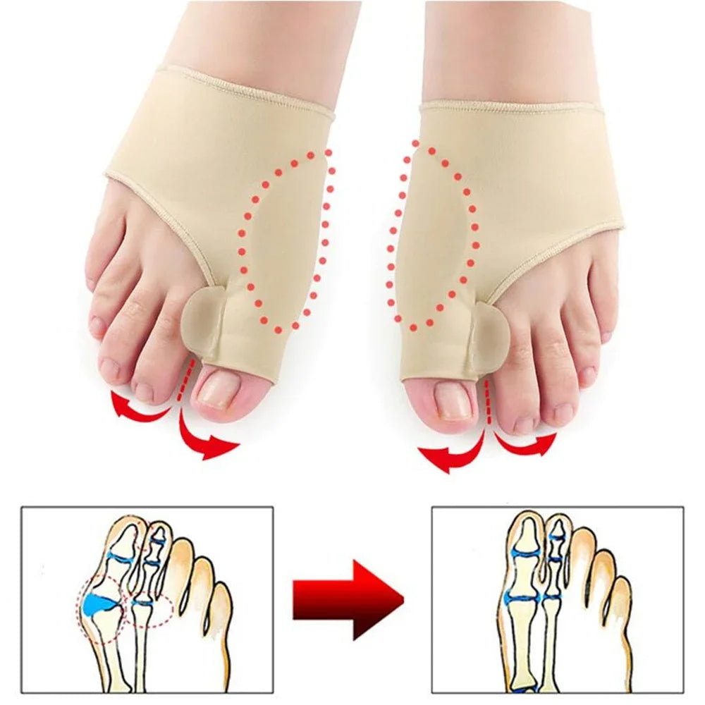 Bunion Corrector Sleeves