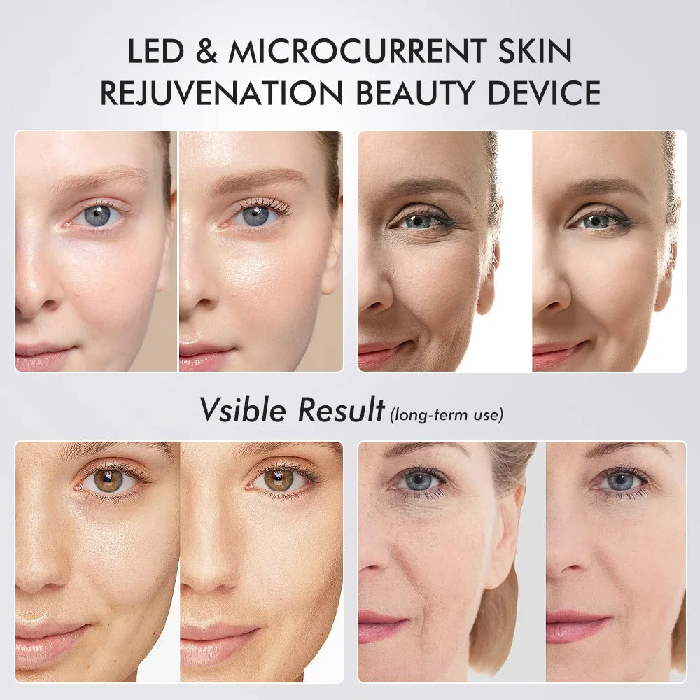 EMS Face & Neck Lift Massager before and after