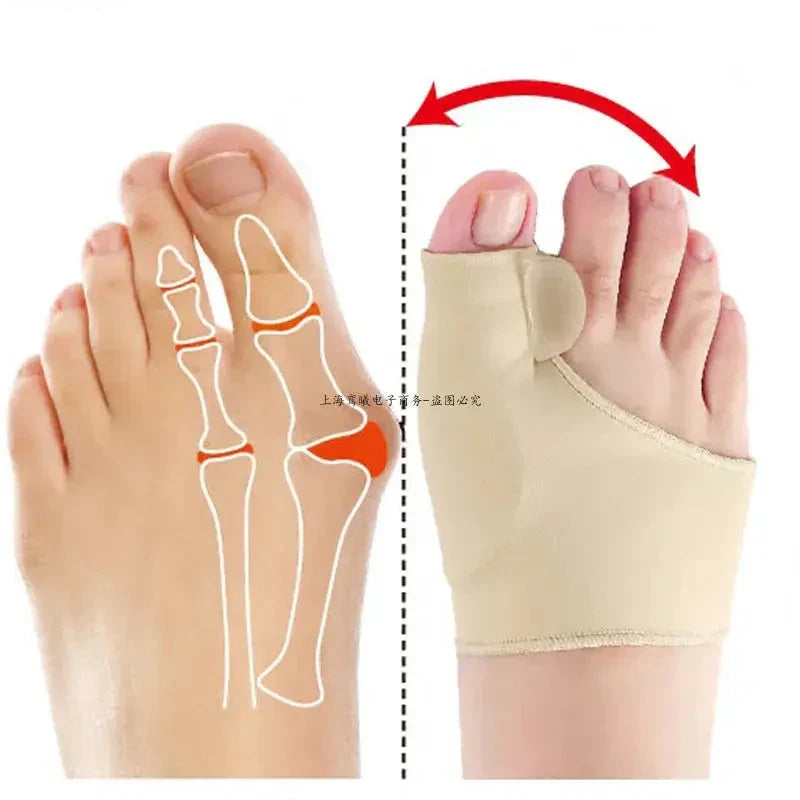Image demonstrating how the Bunion Corrector Sleeves work to realign the big toe and relieve bunion discomfort