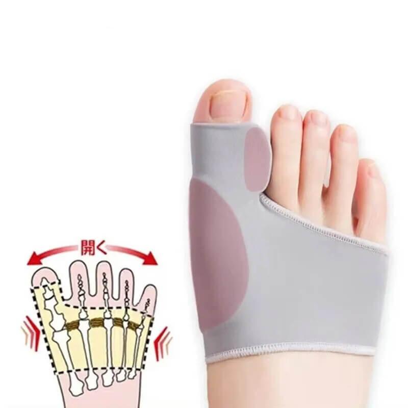 Illustration showing the use of Hallux Valgus Bunion Corrector for toe realignment